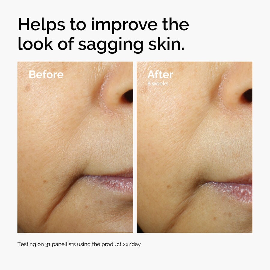 caffeine-3-escin-1-face-serum-o0 ord-caffeine-3pct-escin-1pct-face-serum-before-after-sagging.jpg