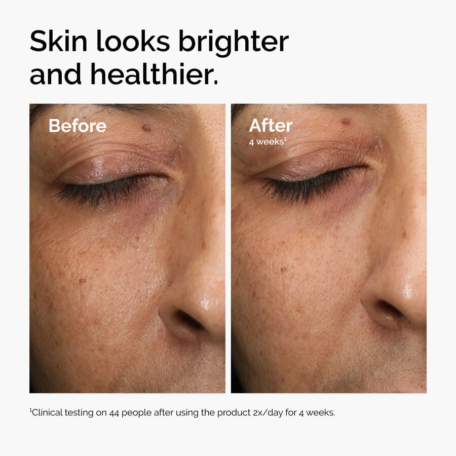 multi-antioxidant-radiance-serum-a5 ord-mars-before-after-healthy.jpg