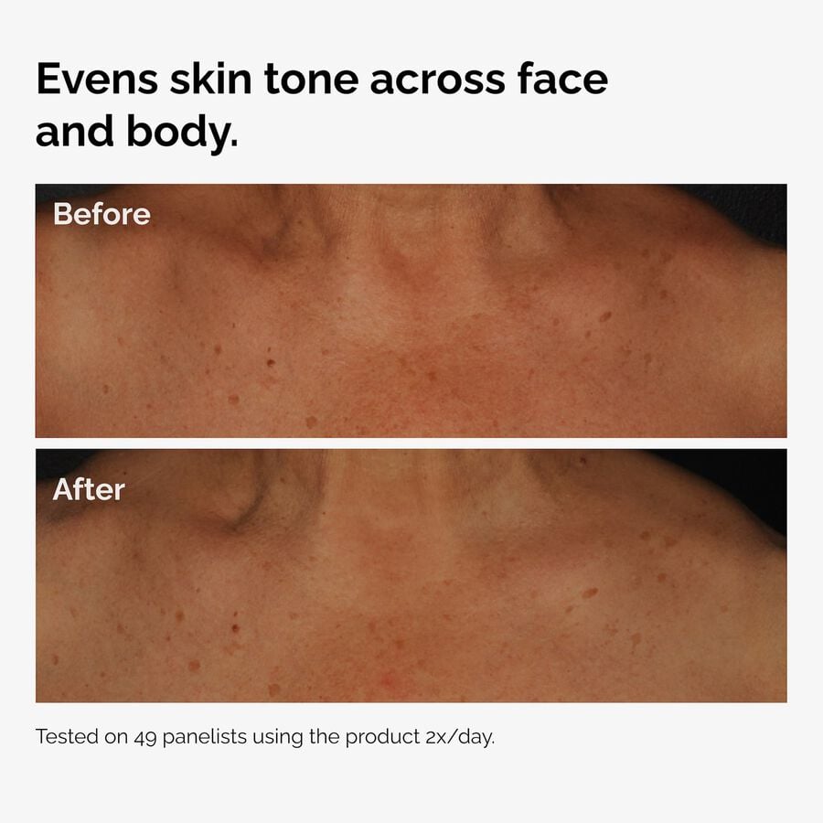 the-body-care-collection-i2 ord-niacinamide-face-body-serum-before-after-even-tone-graphic.jpg